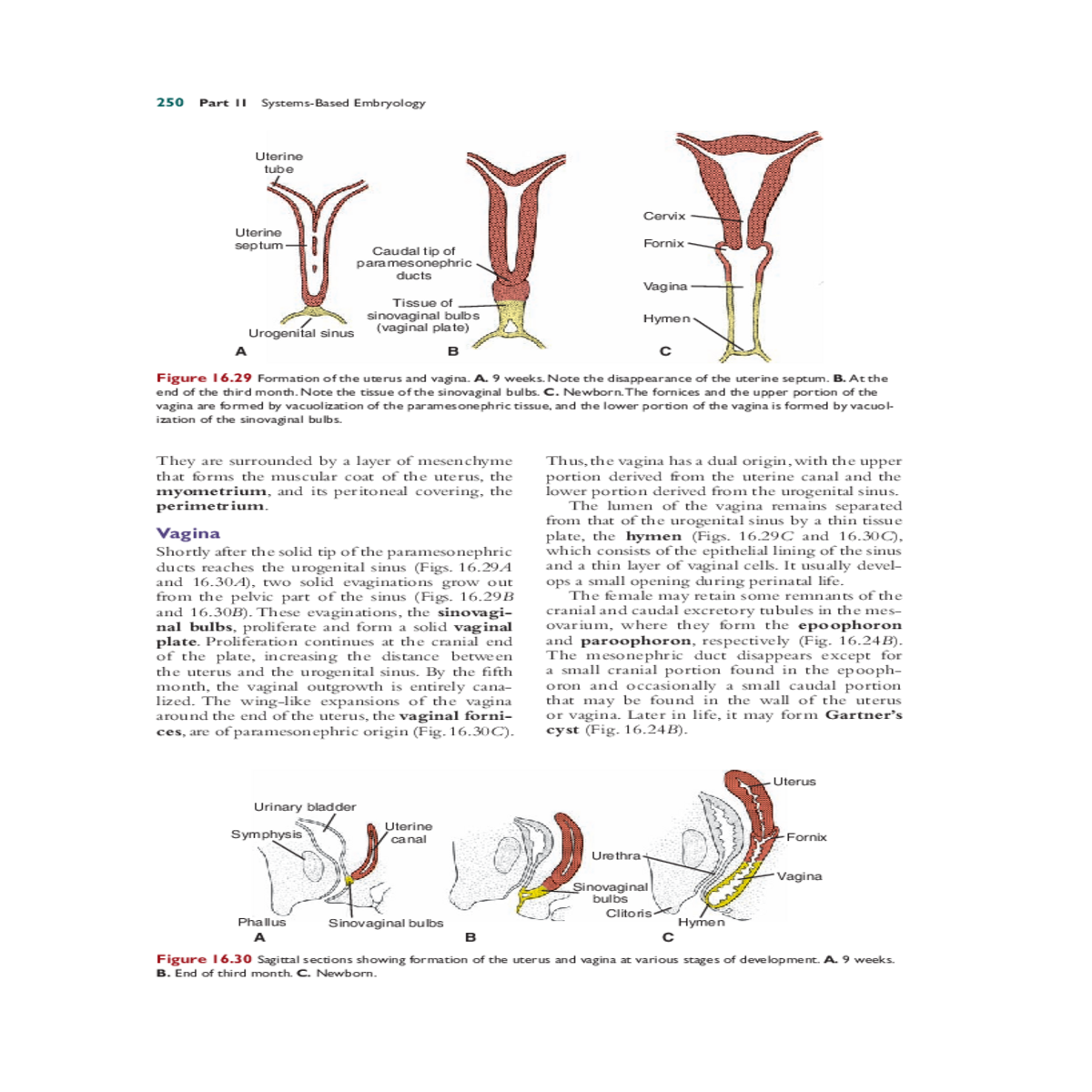 note the disappearance the uterine septum