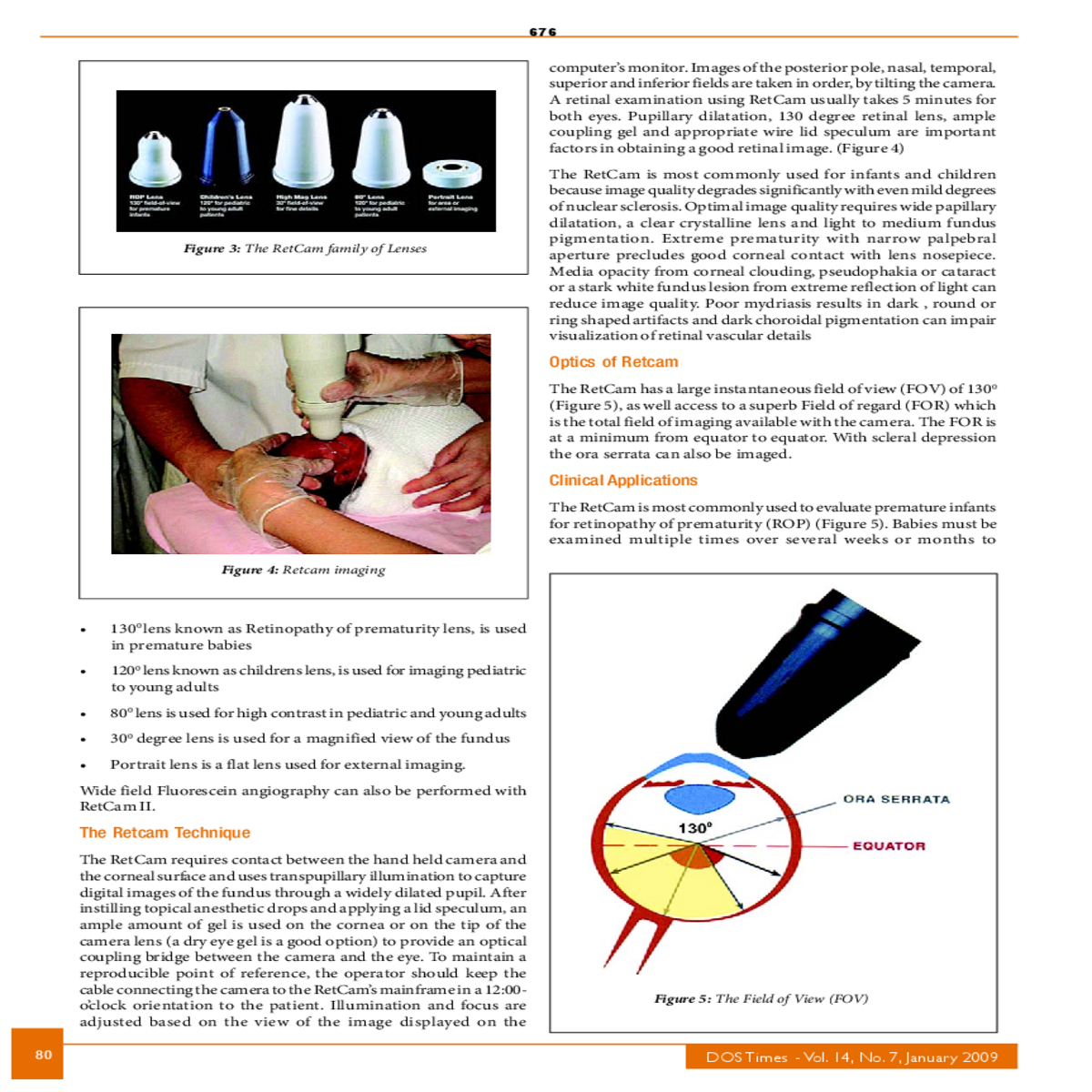 after instilling topical anesthetic drops and appl