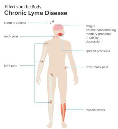 Effects of Lyme disease
