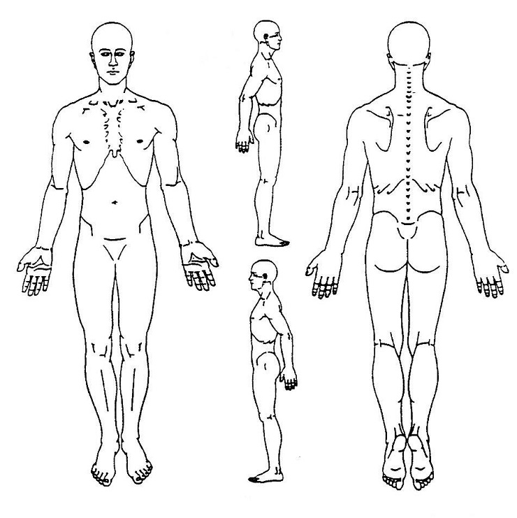 diagram the location of clients pain