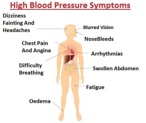 High Blood Pressure Symptoms