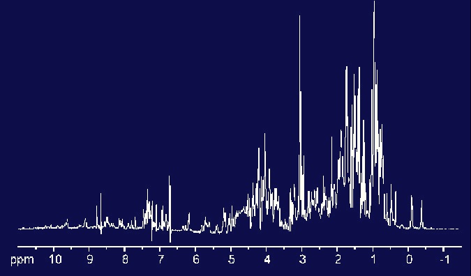 NMR spectroscopy help code